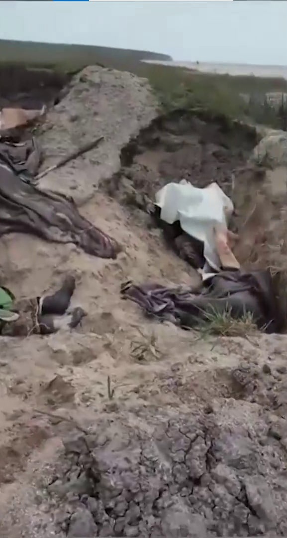 Шокированный солдат ВСУ снимает убитых и раненых украинских военных (18+)