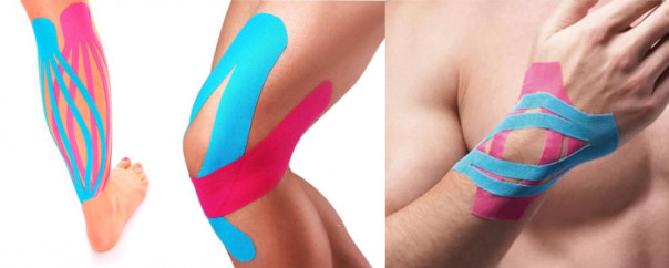 Кинейзиотейпирование при растяжении суставов, кисти, икр и травм колена