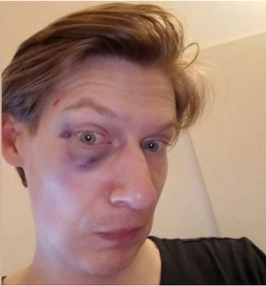 Чехи избили российского либер-активиста за поддержку Украины