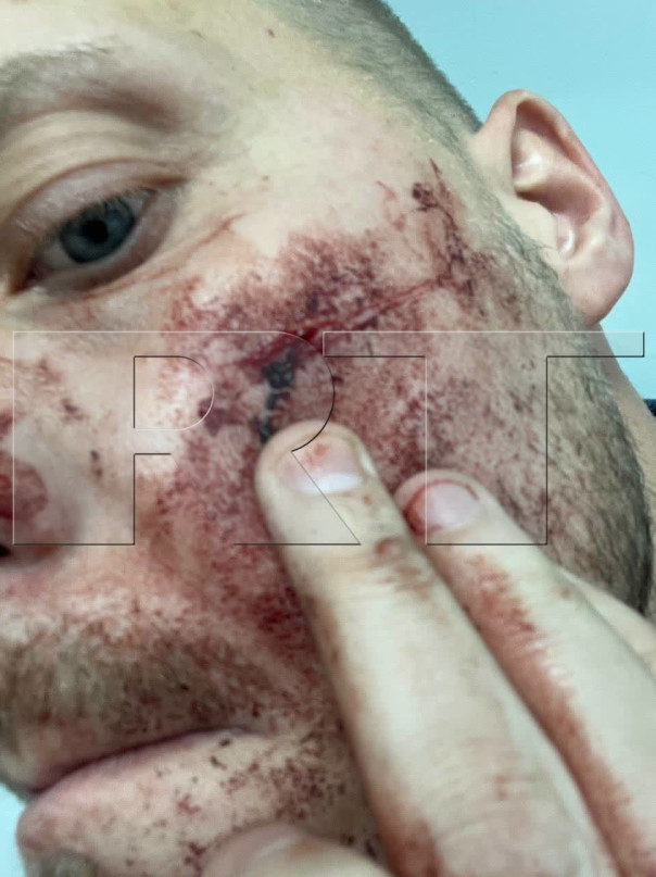 На бывшего французского спецназовца Адриана Боке, который последние месяцы освещал события в Донбассе, напали в Стамбуле.