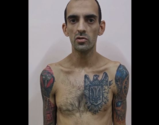 Свежеиспеченный «герой» Украины вновь оказался матерым нацистом — «азовец»* усыплял раненных, чтобы проверить действие препаратов