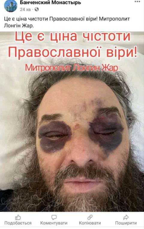 На Украине жестоко избили православного архиерея, а из Эстонии выгнали митрополита ЭПЦ