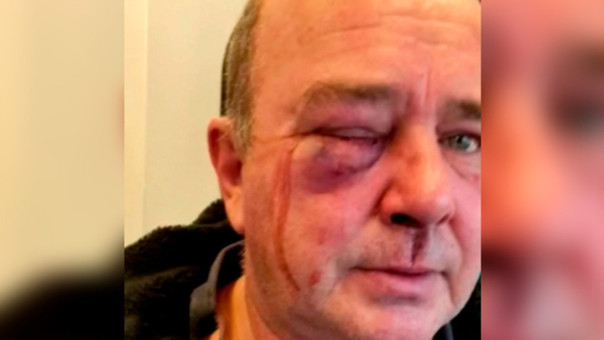 Под Киевом сотрудники ТЦК избили 55-летнего на глазах у полицейских