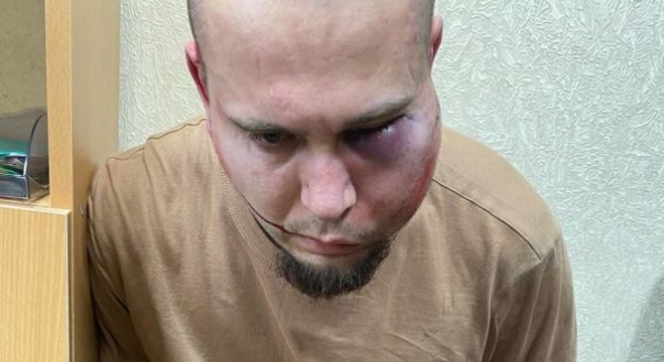 В Беларуси задержан врач-нацист со своим другом, которые на стриме зиговали и радовались смертям российских и белорусских граждан в "Крокус Сити Холл"