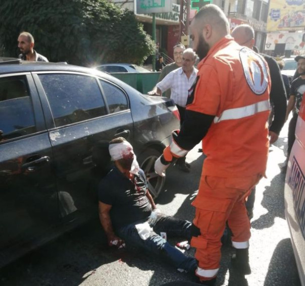 Количество пострадавших после серии массовых взрывов пейджеров в Ливане возросло до 2800 человек