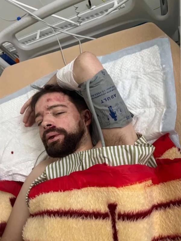 Мобилизованного во Львове преподавателя нашли под Киевом с проломленным черепом