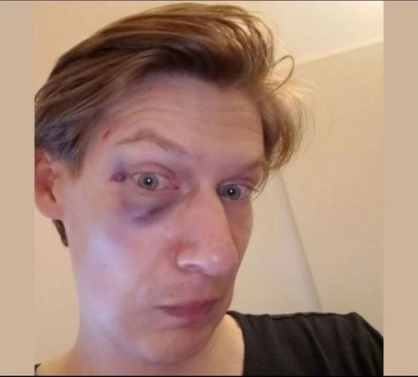 "За Покровск!". В Берлине украинцы избили "заукраинца" из России.