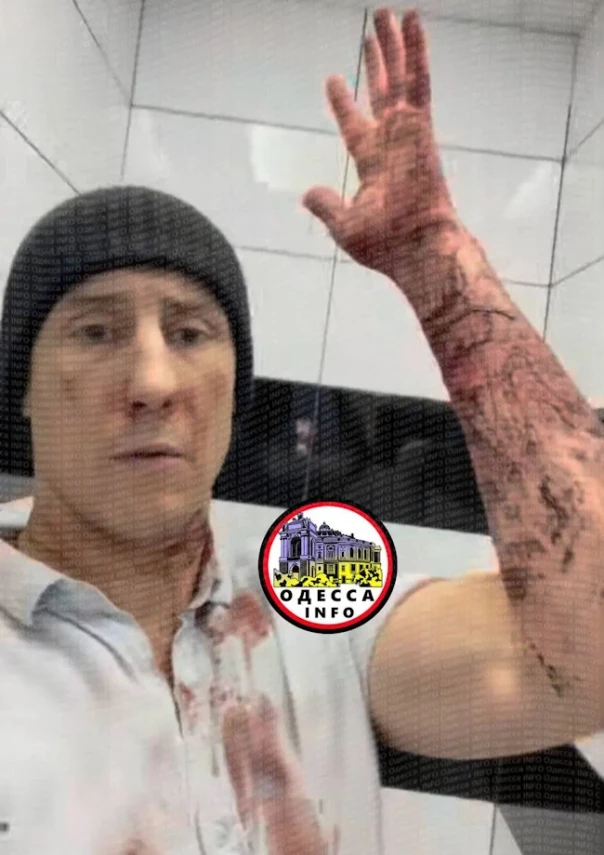 Зверства нацистов в Одессе. «Ухылянт» сбежал из ТЦК с порезаными венами