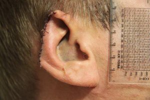 О «глазках на асфальте» и не только...