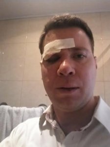 В центре Симферополя избили гражданина США