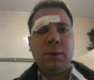 В центре Симферополя избили гражданина США